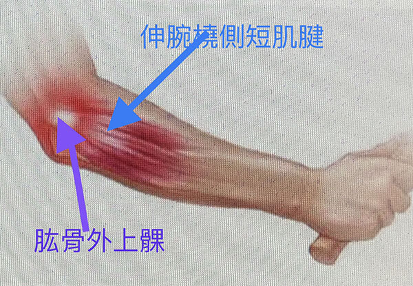 解剖構造