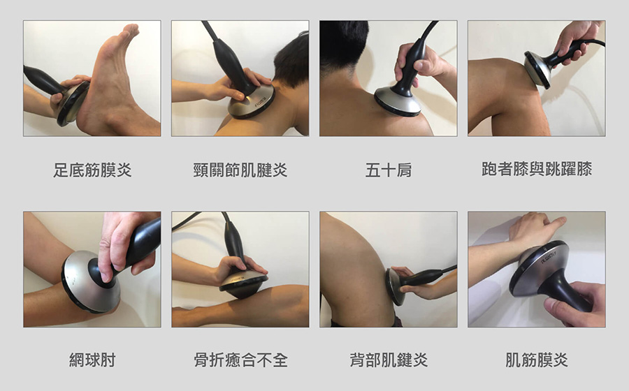 體外震波適應症,新北中和復健科-祥明診所 體外震波適應症